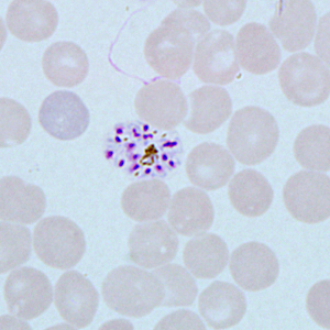 Case271_E.jpg