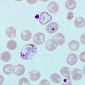 Case271_F.jpg