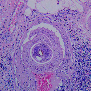 Case272_A.jpg