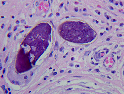 Case272_B.jpg