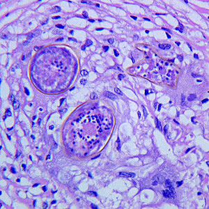 Case272_C.jpg