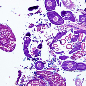 Case275_D.jpg