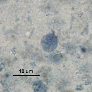 Case276_C.jpg