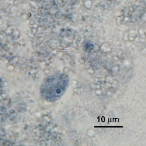 Case276_D.jpg