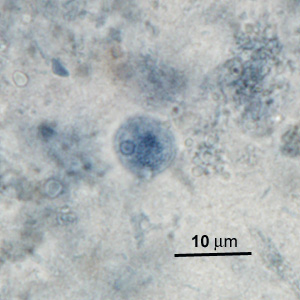 Case276_E.jpg