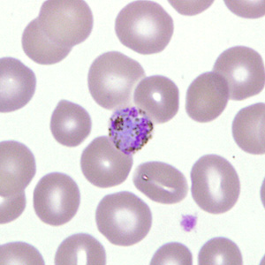 Case277_E.jpg