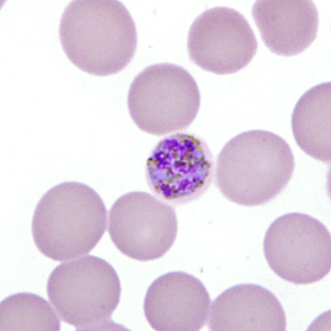 Case277_F.jpg