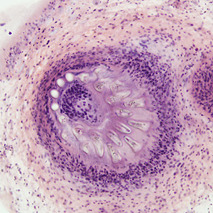 Case278_F.jpg