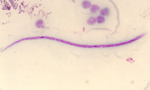 Case279_A.jpg