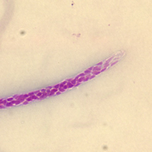 Case279_B.jpg