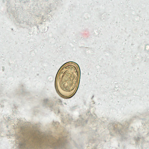 Case281_C.jpg Case281_C