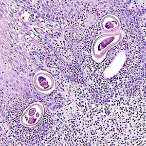 Case283_A.jpg