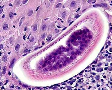 Case283_E.jpg