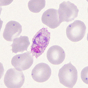 Case285_D.jpg