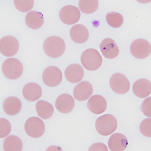 Case287_A.jpg