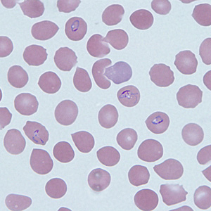Case290_B.jpg