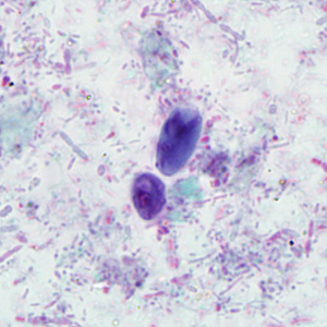 Case293_A.jpg