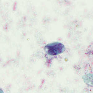 Case293_C.jpg