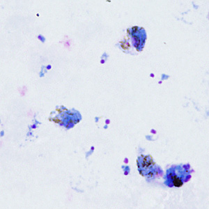 Case295_A.jpg
