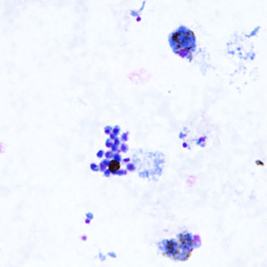Case295_B.jpg