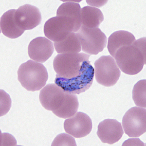 Case295_H.jpg