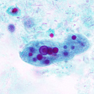 Case296_B.jpg