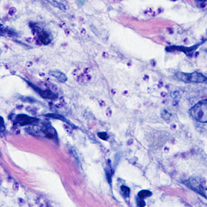 Case298_A.jpg