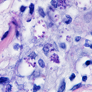 Case298_B.jpg