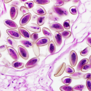 Case299_C.jpg
