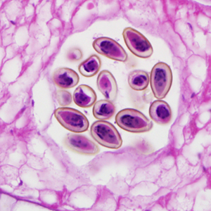 Case299_D.jpg