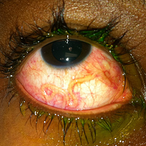 Case301_A.jpg