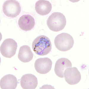 Case302_F.jpg