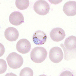 Case302_H.jpg