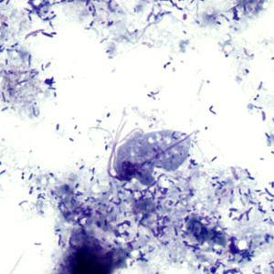 Case303_A.jpg