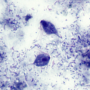 Case303_D.jpg