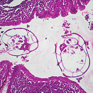Case305_A.jpg