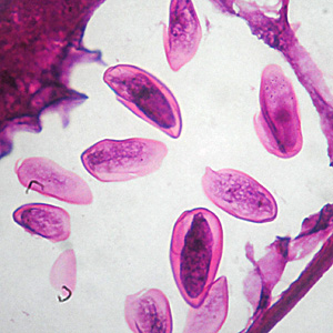 Case305_D.jpg