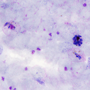 Case306_B.jpg
