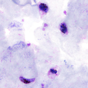 Case306_C.jpg