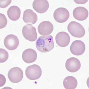 Case306_D.jpg