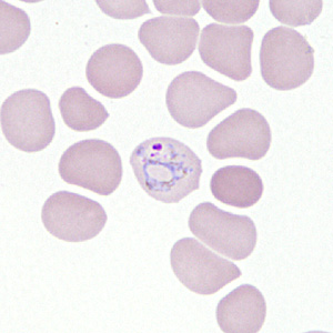 Case306_E.jpg