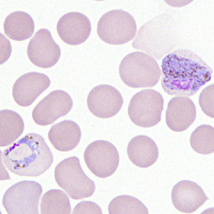 Case306_F.jpg