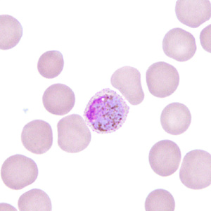 Case306_G.jpg