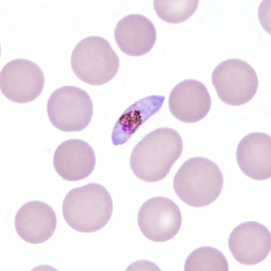 Case306_H.jpg