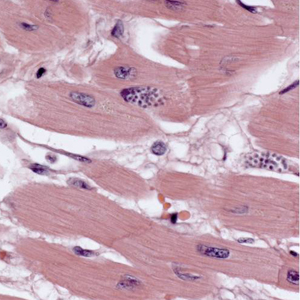 Case308_A.jpg