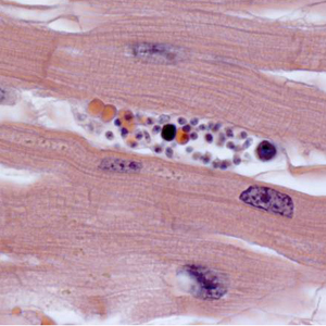 Case308_C.jpg