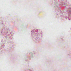 Case310_A.jpg