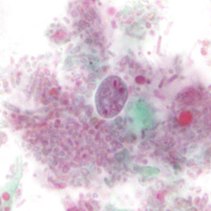 Case310_E.jpg