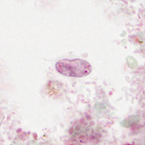 Case310_F.jpg