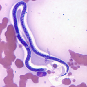 Case311_B.jpg